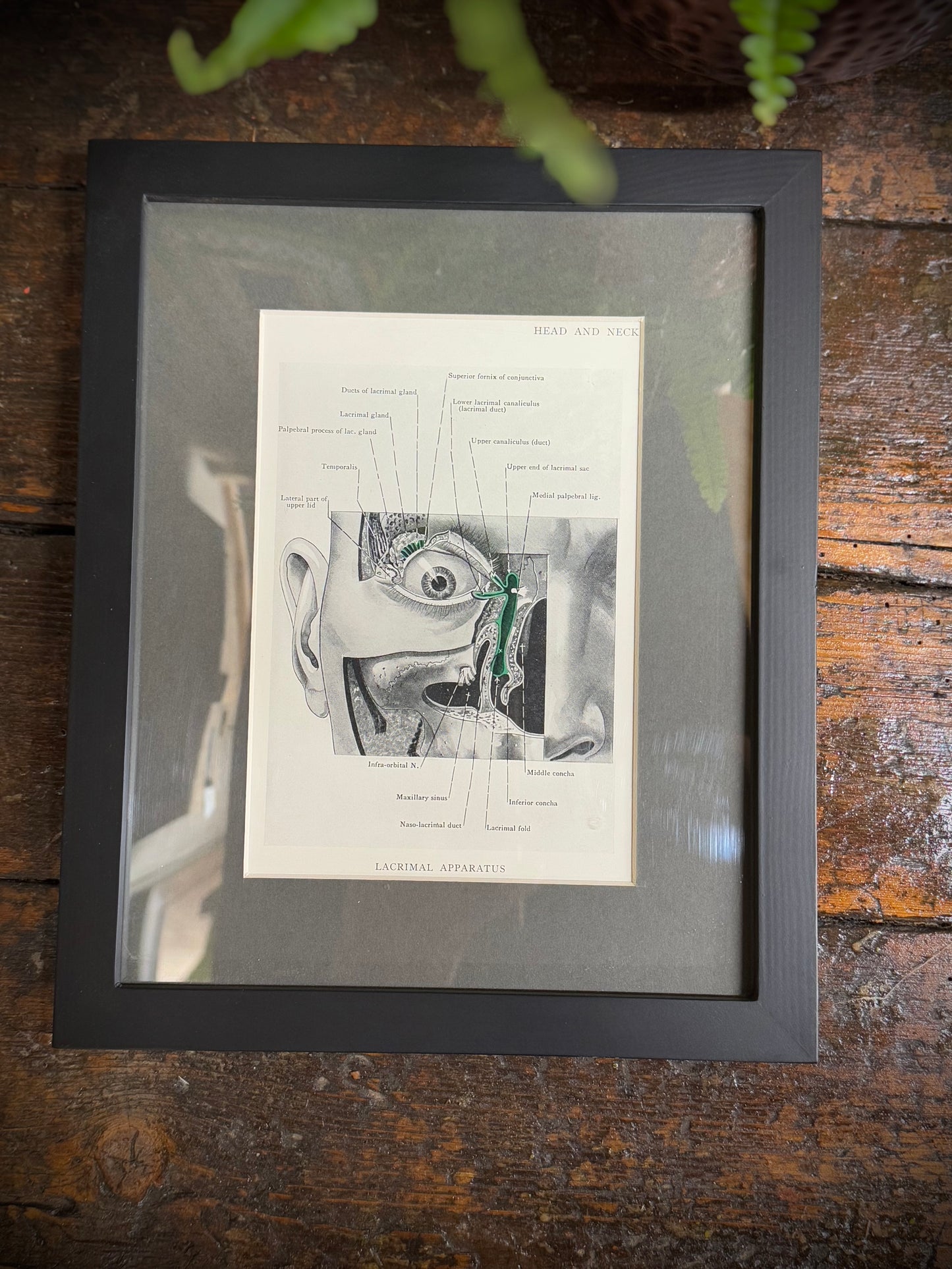 Framed Antique Anatomy Print 1920s Medical Book Plate Wall Art Picture C