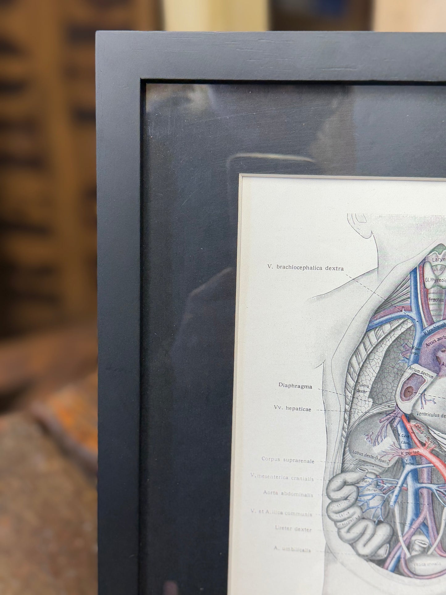 Framed Antique Anatomy Print 1920s Medical Book Plate Wall Art Picture H