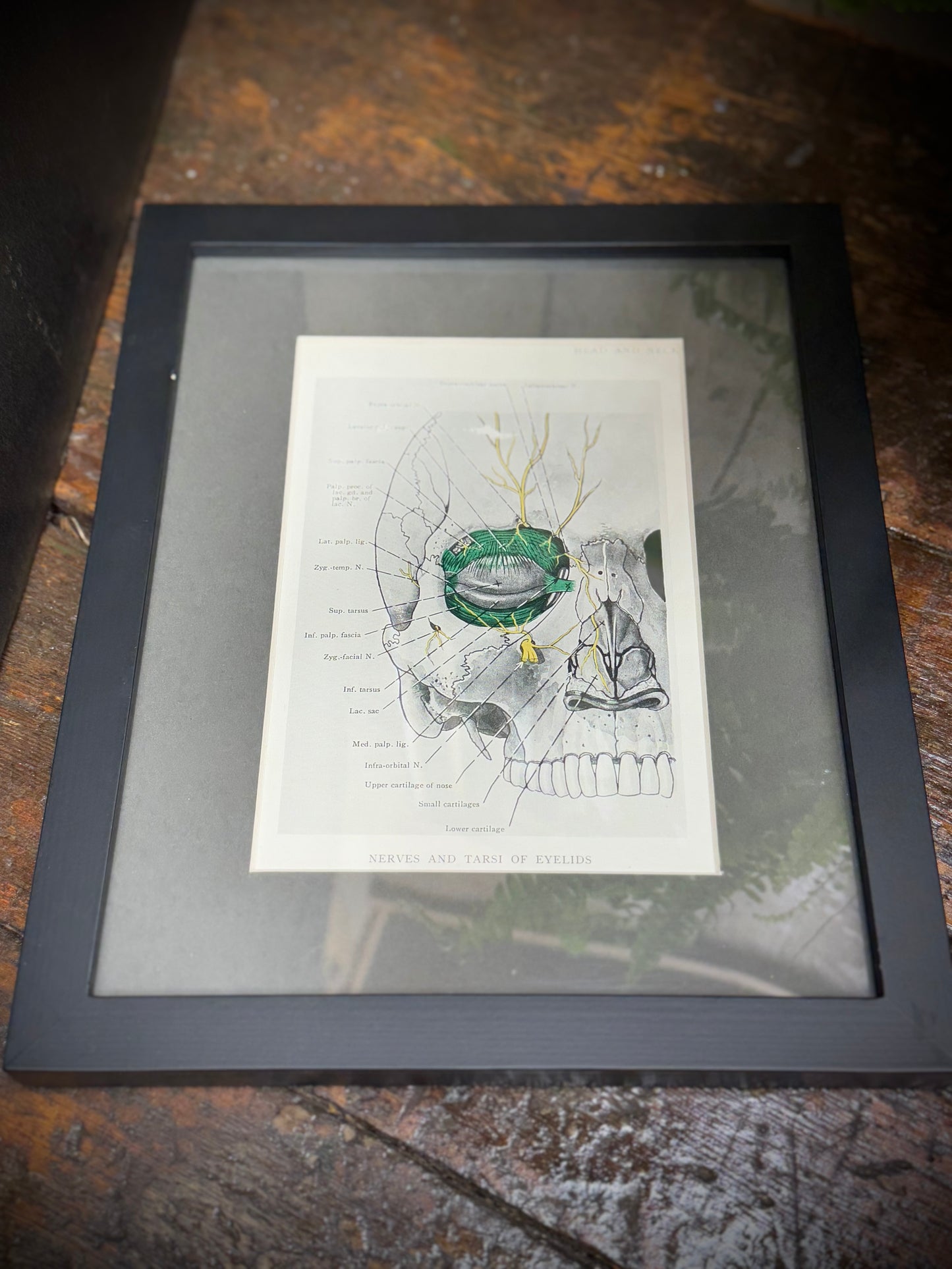 Framed Antique Anatomy Print 1920s Medical Book Plate Wall Art Picture A