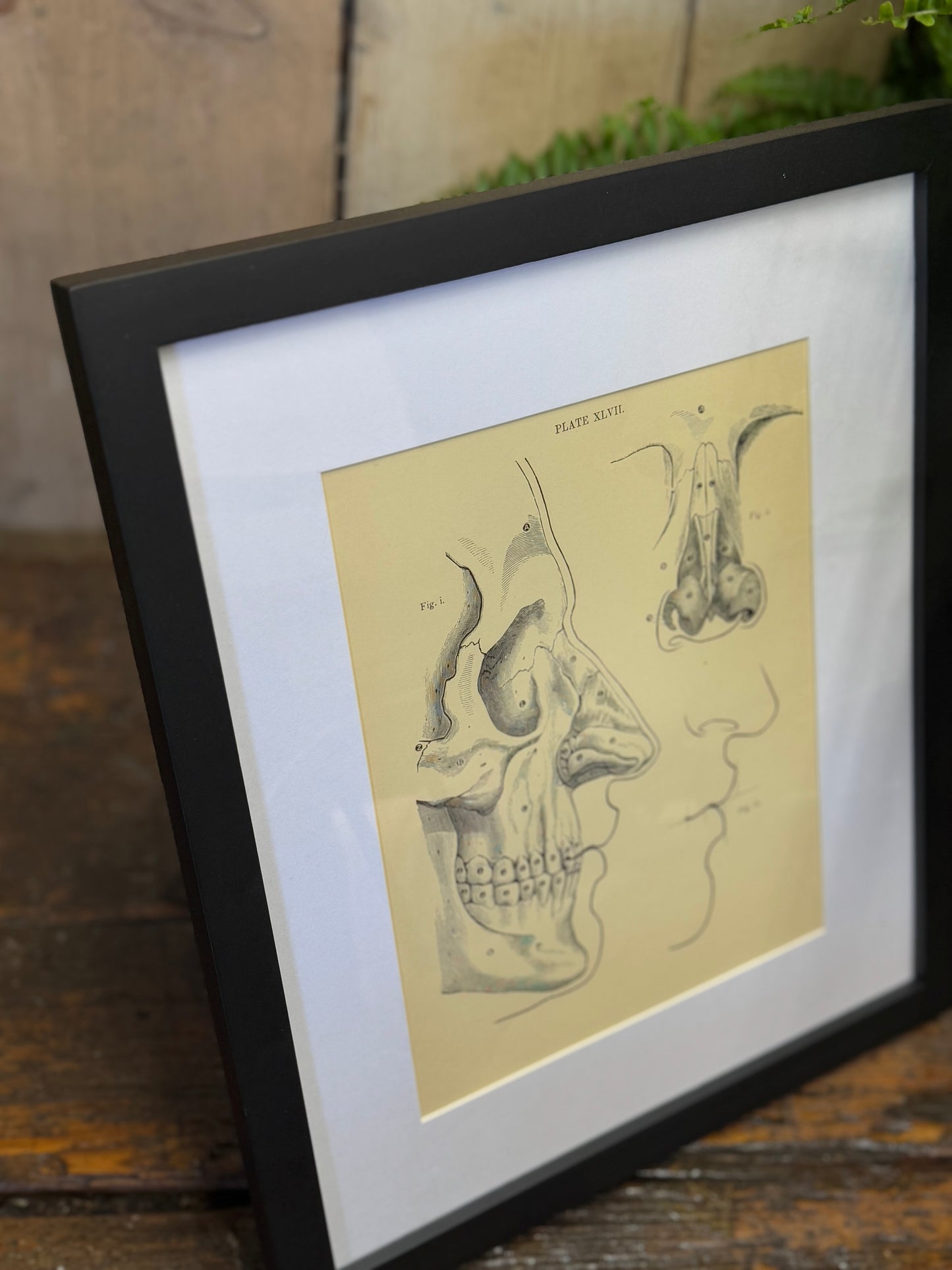 Victorian Anatomy Engraving – Antique Medical Print L
