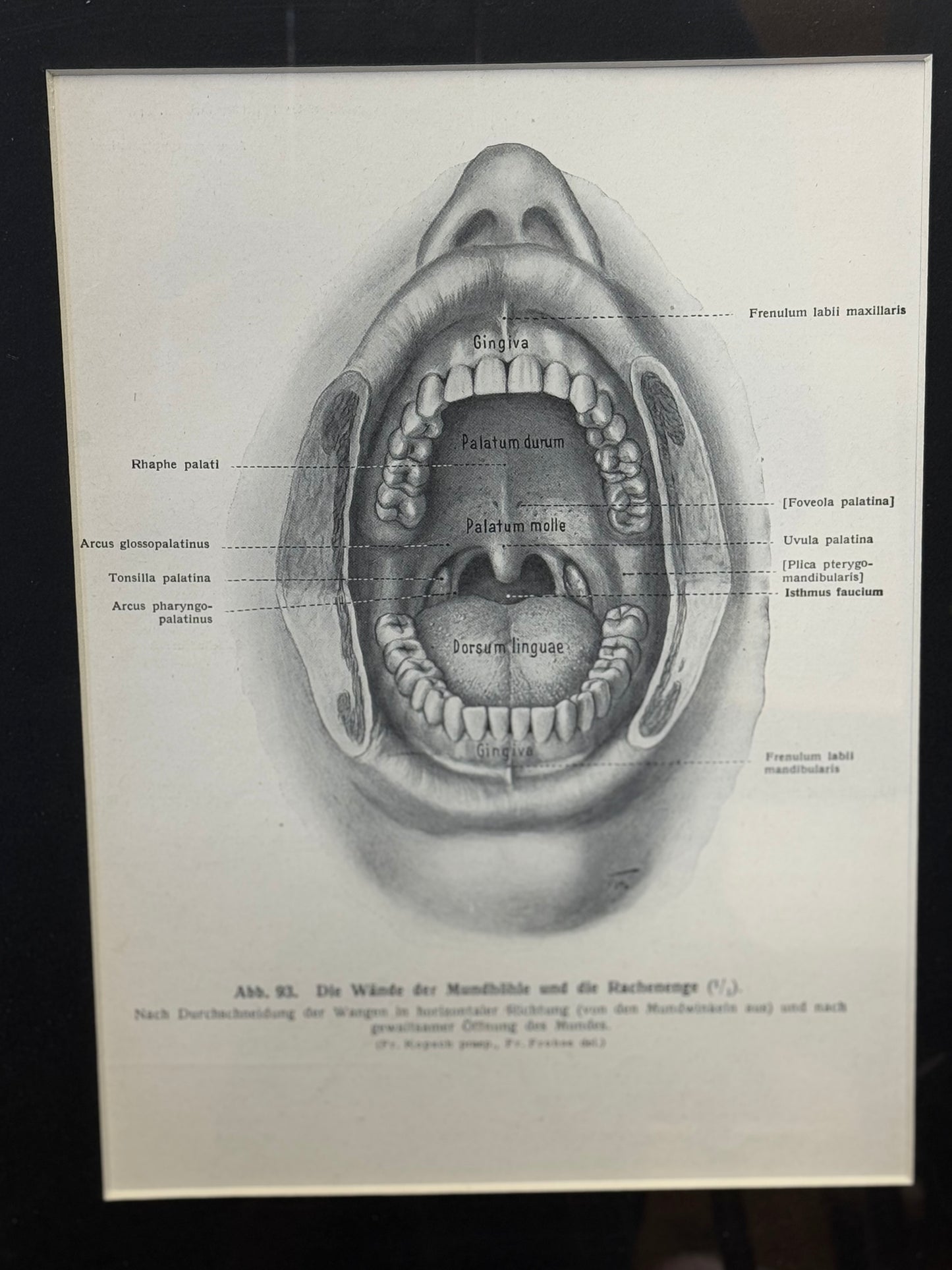 Victorian Anatomy Engraving – Antique Medical Print R
