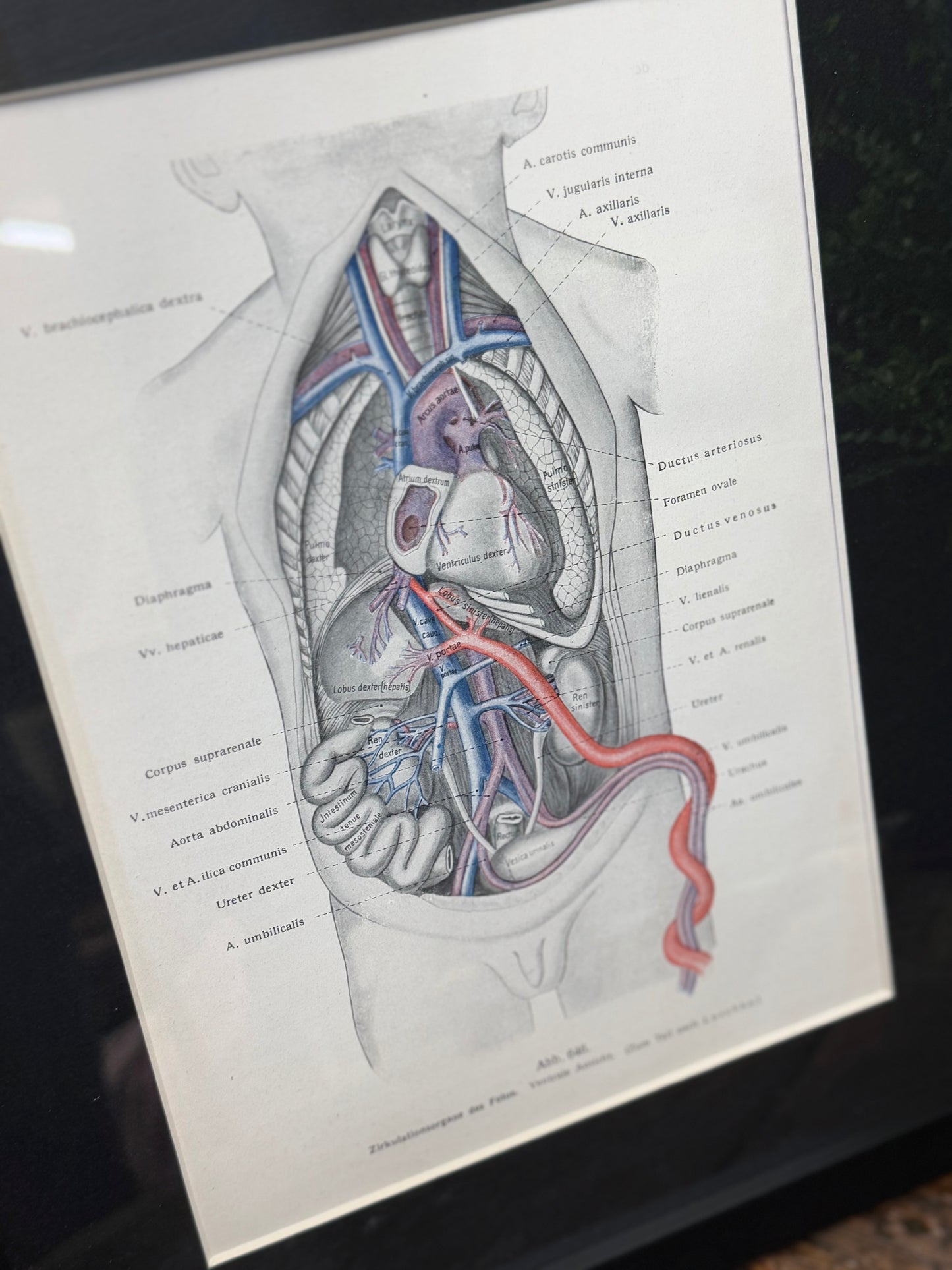 Framed Antique Anatomy Print 1920s Medical Book Plate Wall Art Picture H