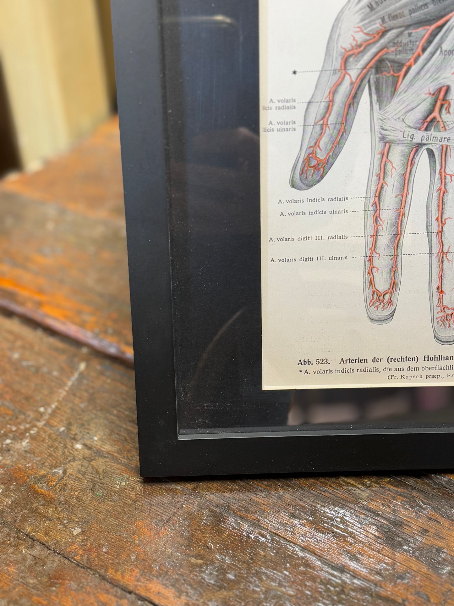 Framed Antique Anatomy Print 1920s Medical Book Plate Wall Art Picture K