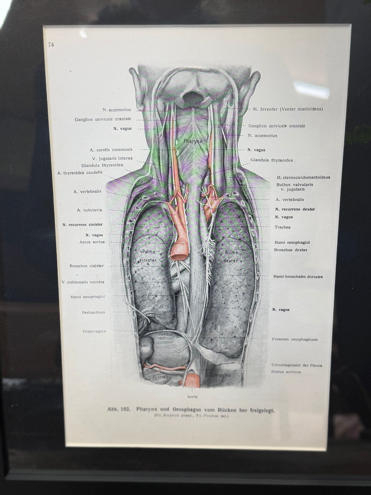 Framed Antique Anatomy Print 1920s Medical Book Plate Wall Art Picture G