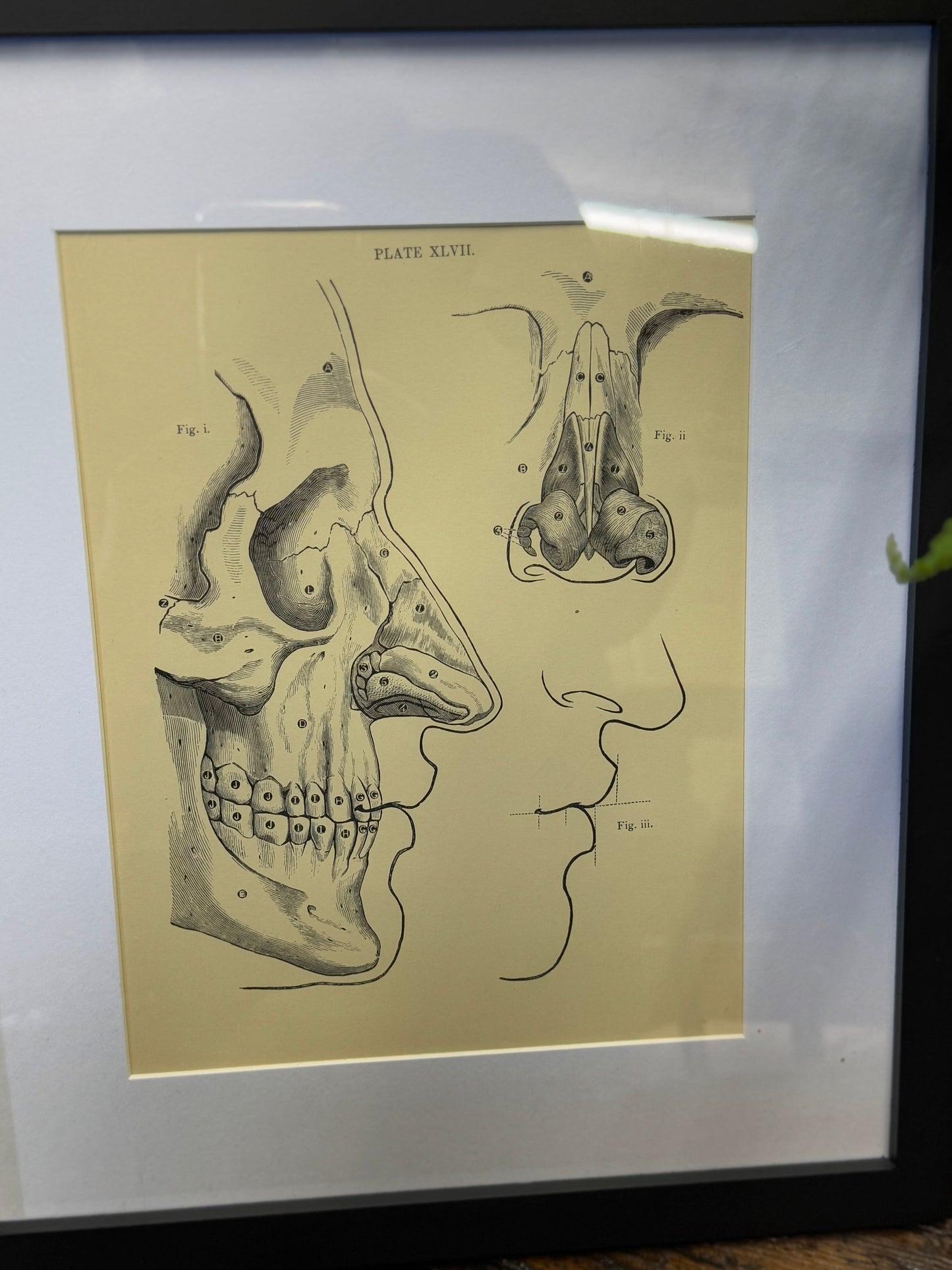 Victorian Anatomy Engraving – Antique Medical Print L