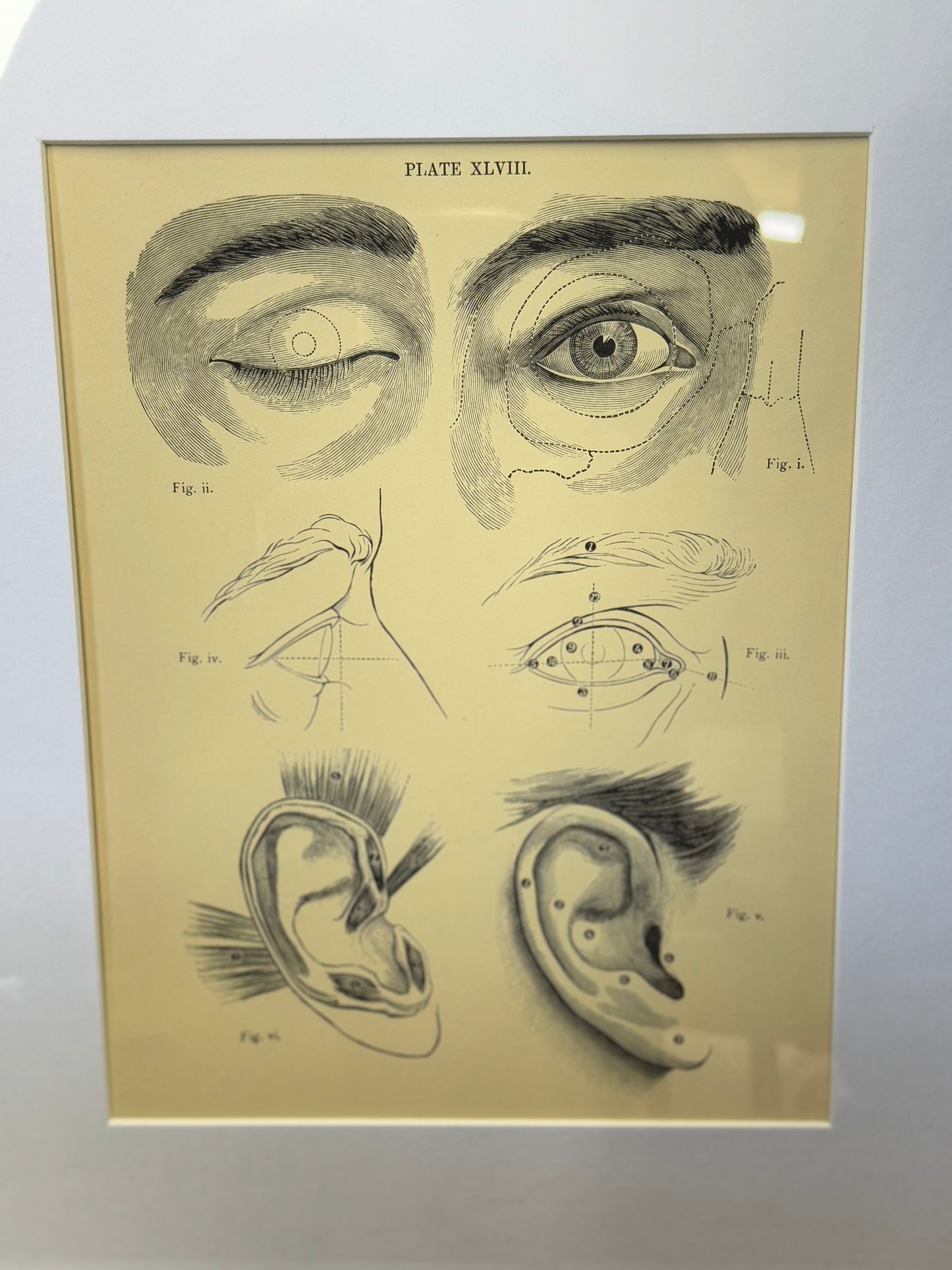 Victorian Anatomy Engraving – Antique Medical Print P