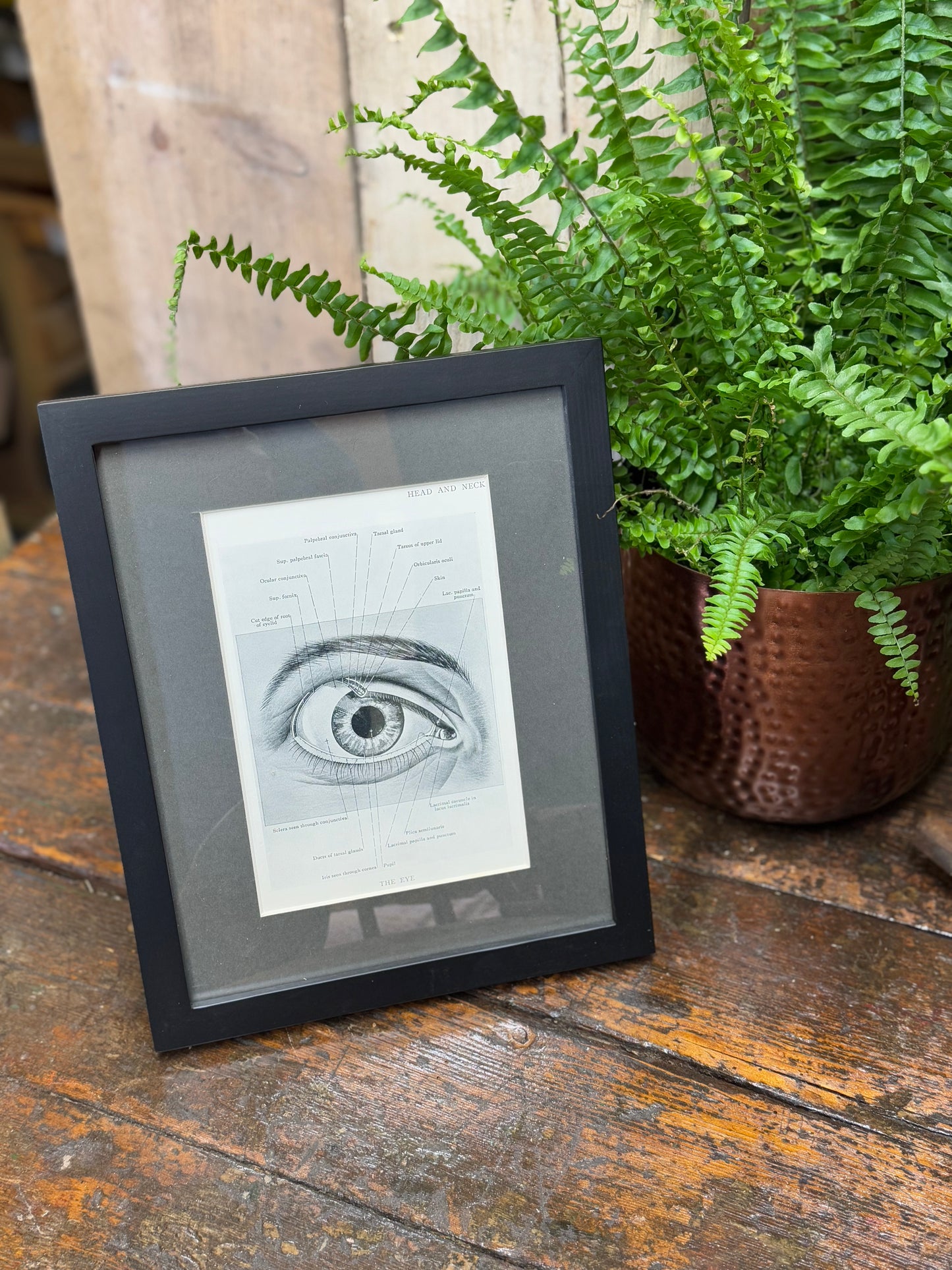 Framed Antique Anatomy Print 1920s Medical Book Plate Wall Art Picture D