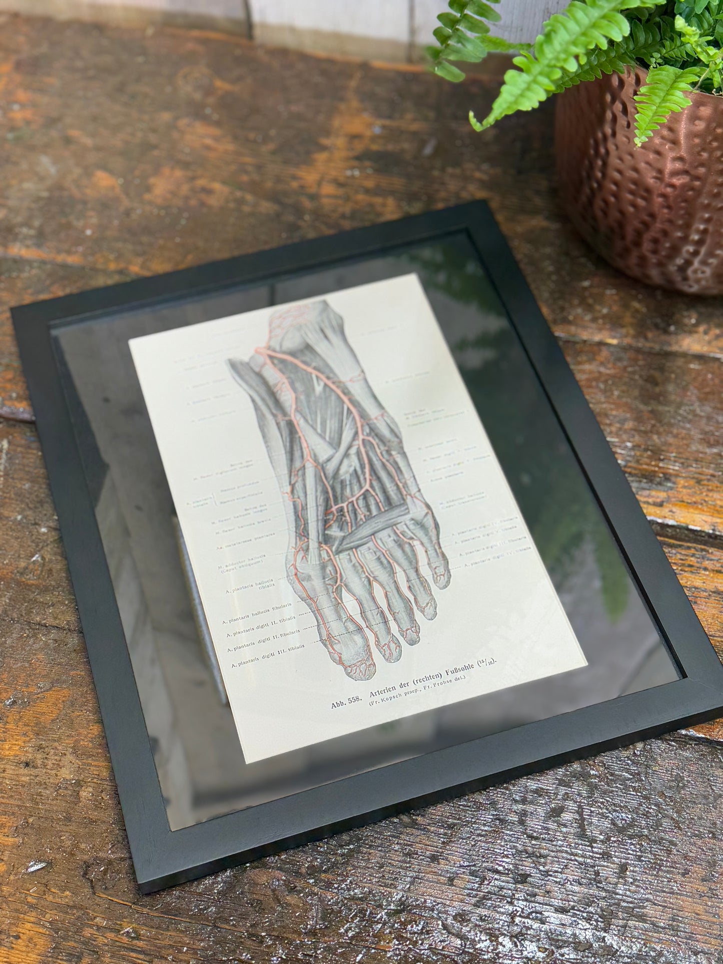 Framed Antique Anatomy Print 1920s Medical Book Plate Wall Art Picture I