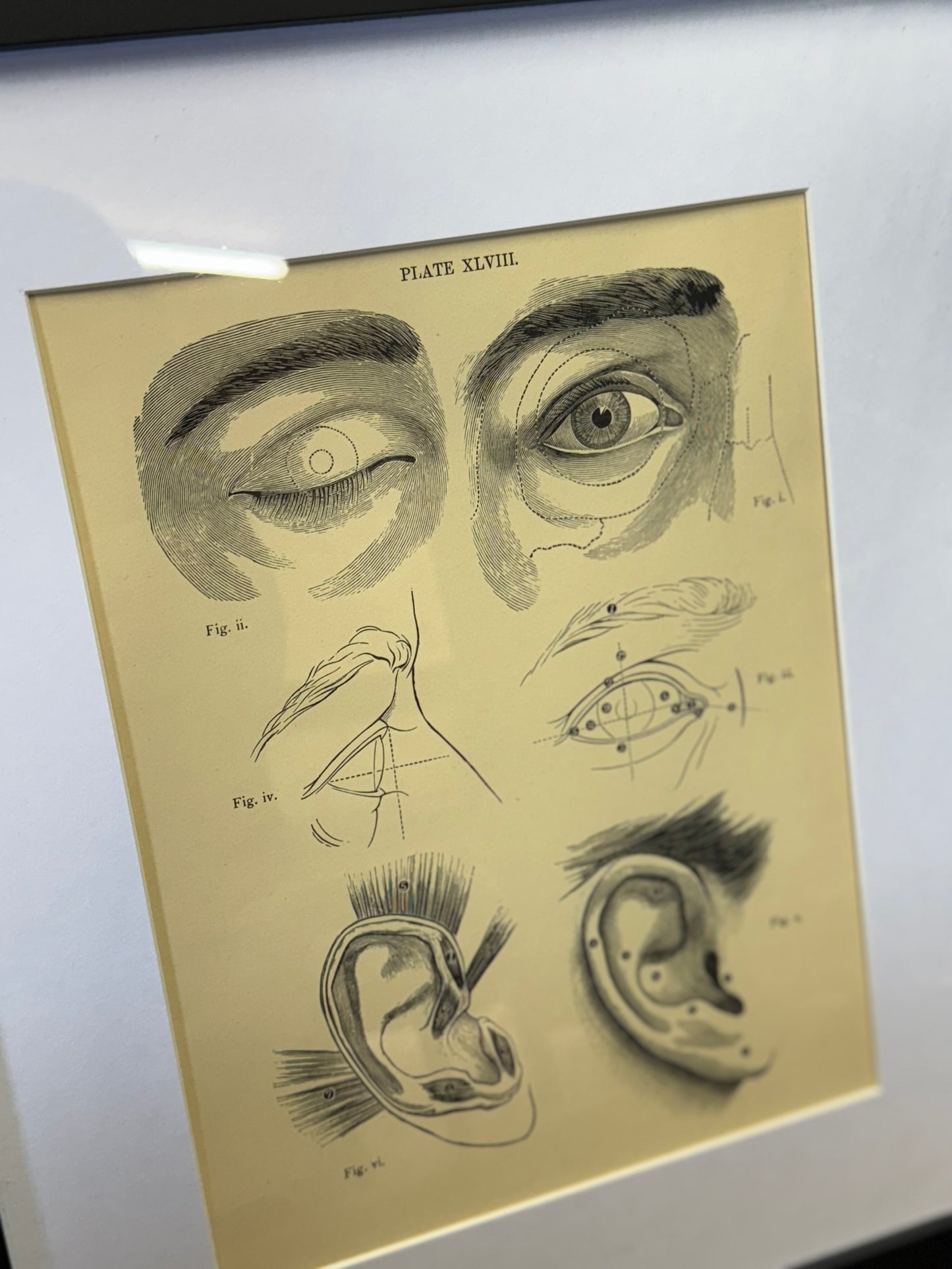 Victorian Anatomy Engraving – Antique Medical Print P