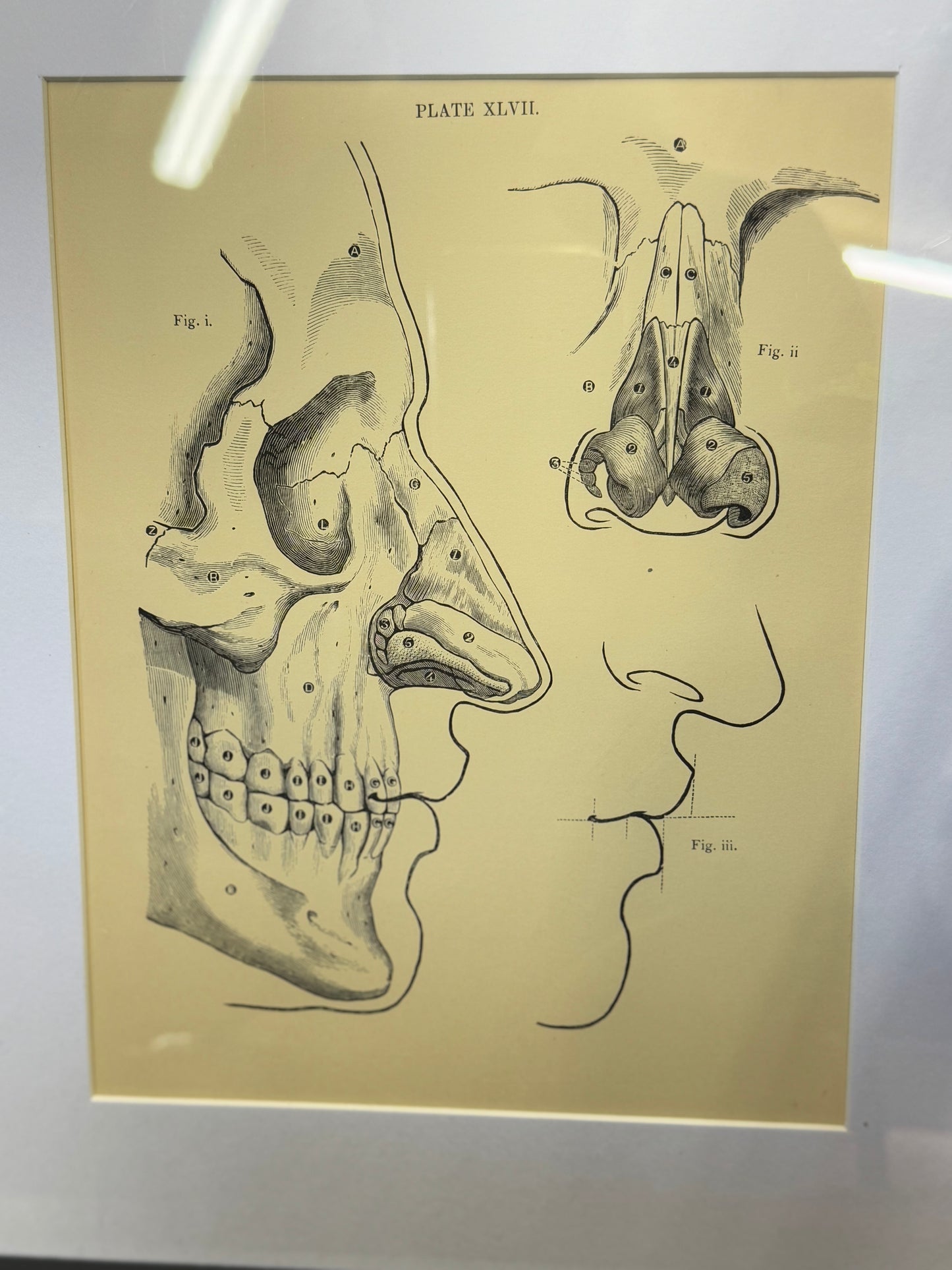 Victorian Anatomy Engraving – Antique Medical Print L