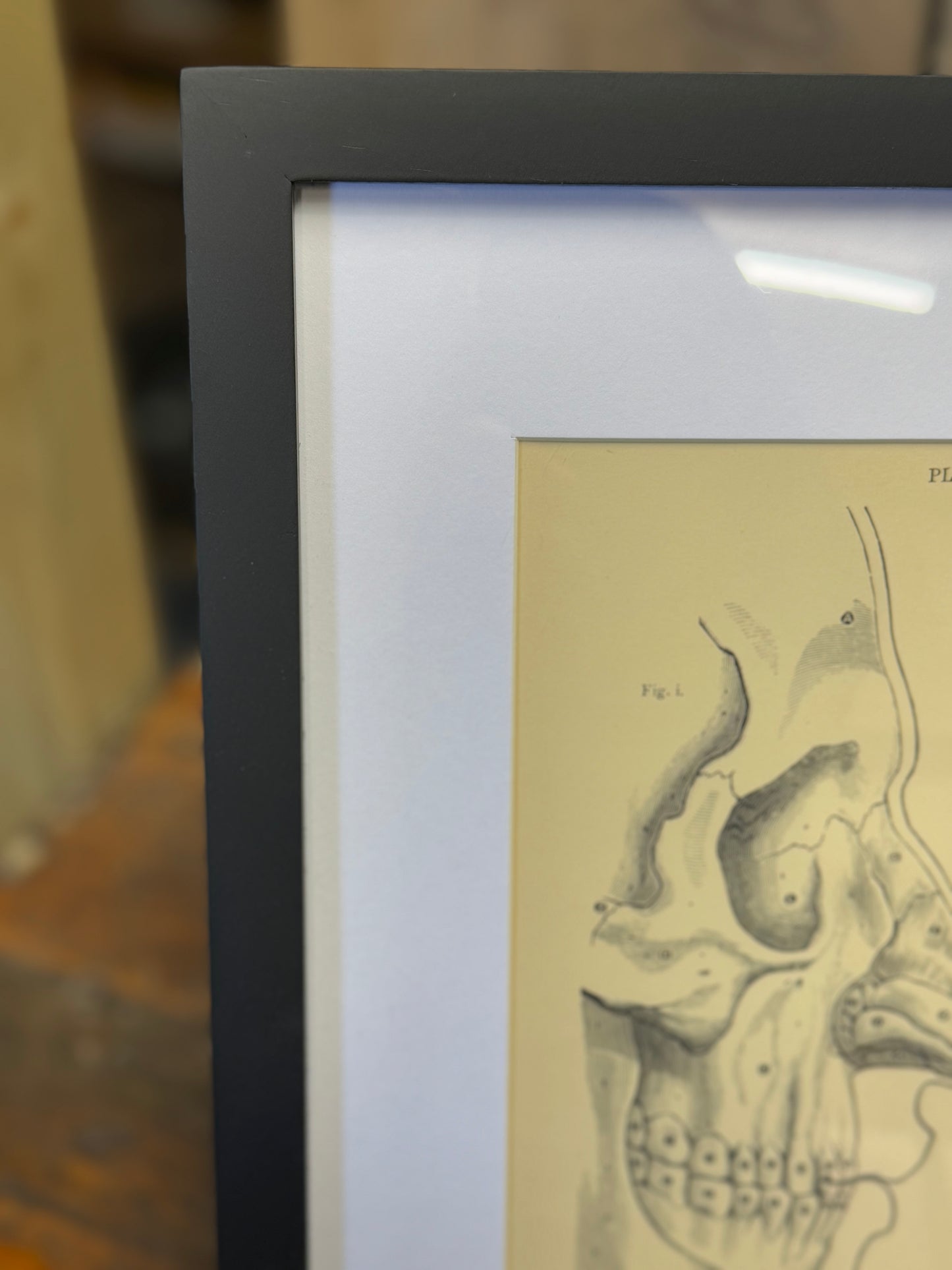 Victorian Anatomy Engraving – Antique Medical Print L
