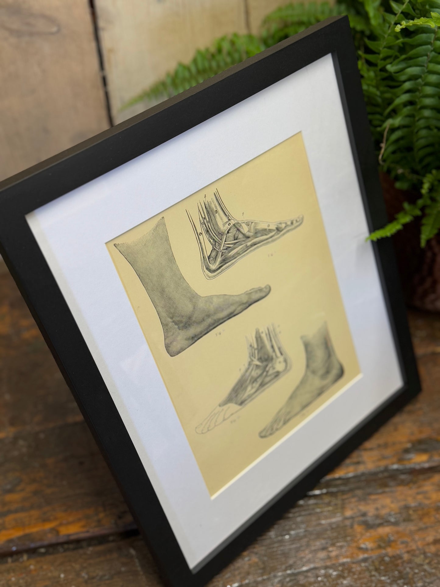 Victorian Anatomy Engraving – Antique Medical Print M