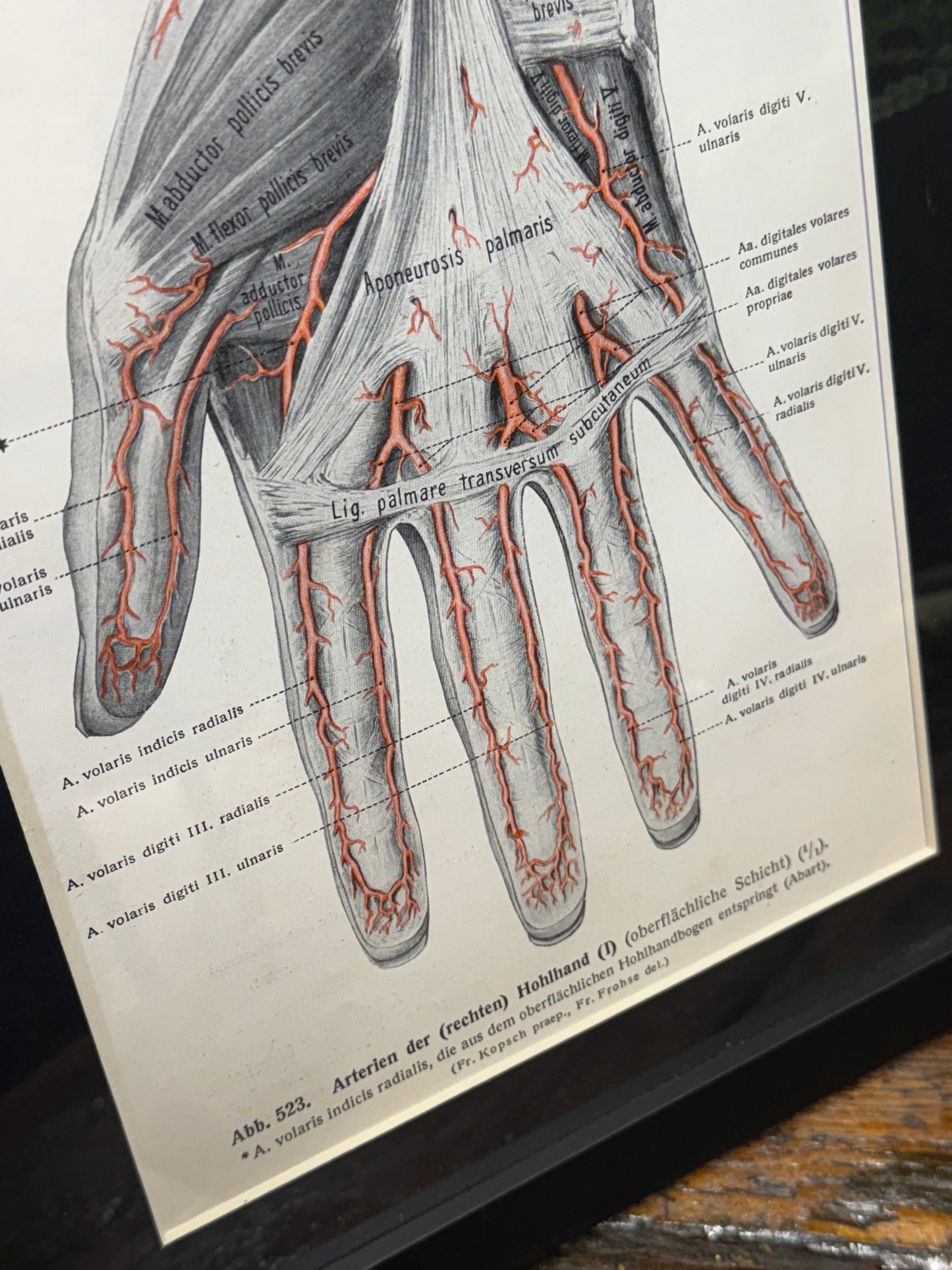 Framed Antique Anatomy Print 1920s Medical Book Plate Wall Art Picture K
