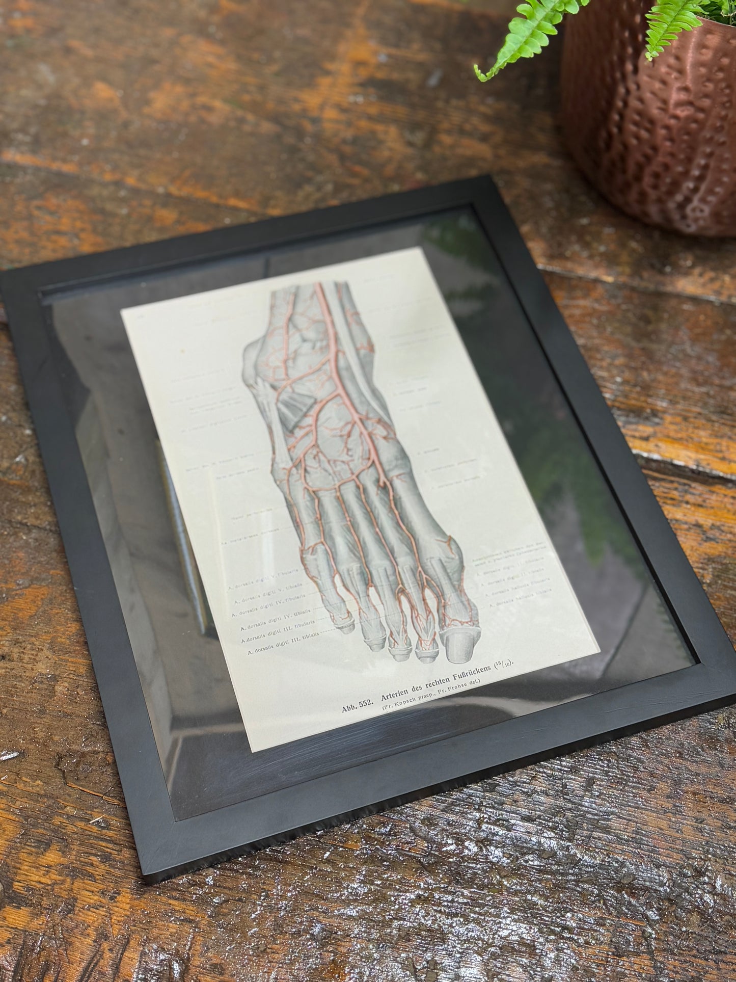 Framed Antique Anatomy Print 1920s Medical Book Plate Wall Art Picture J