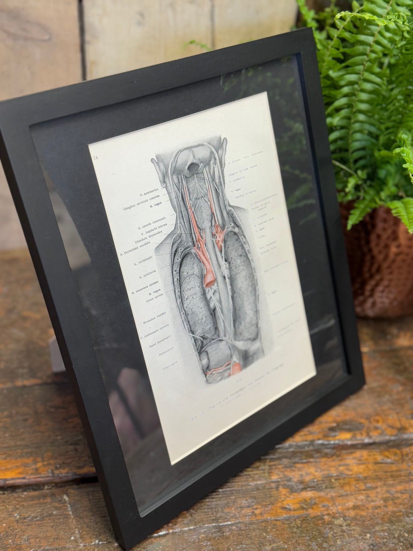 Framed Antique Anatomy Print 1920s Medical Book Plate Wall Art Picture G