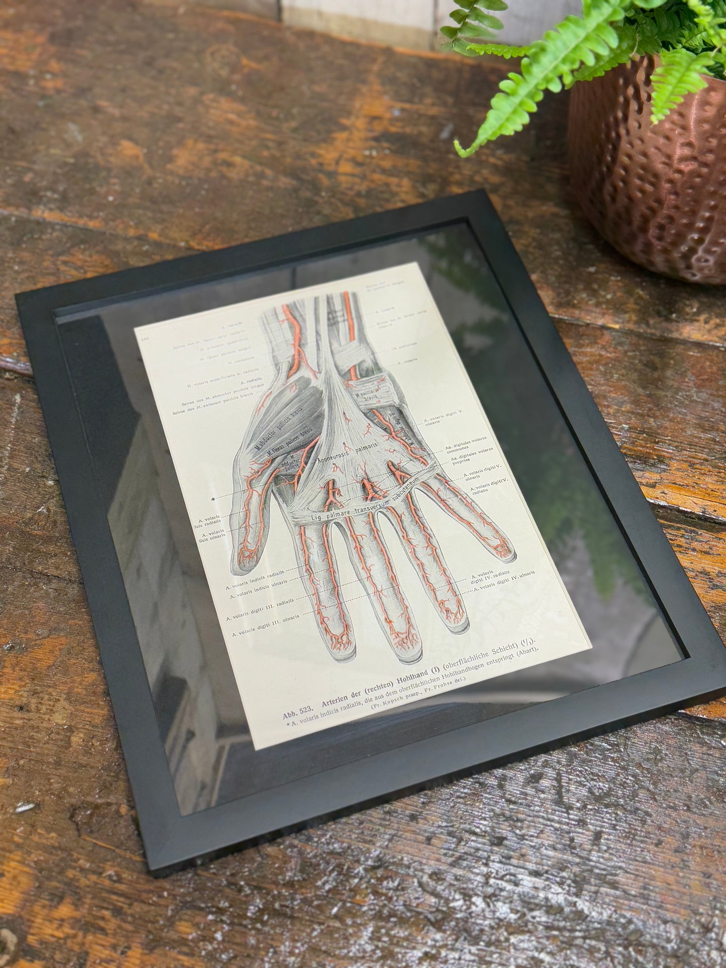 Framed Antique Anatomy Print 1920s Medical Book Plate Wall Art Picture K