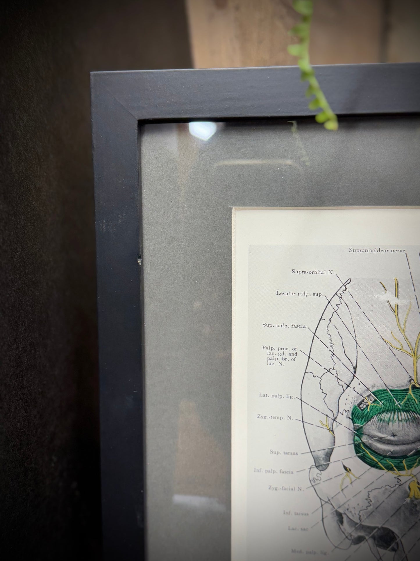 Framed Antique Anatomy Print 1920s Medical Book Plate Wall Art Picture A