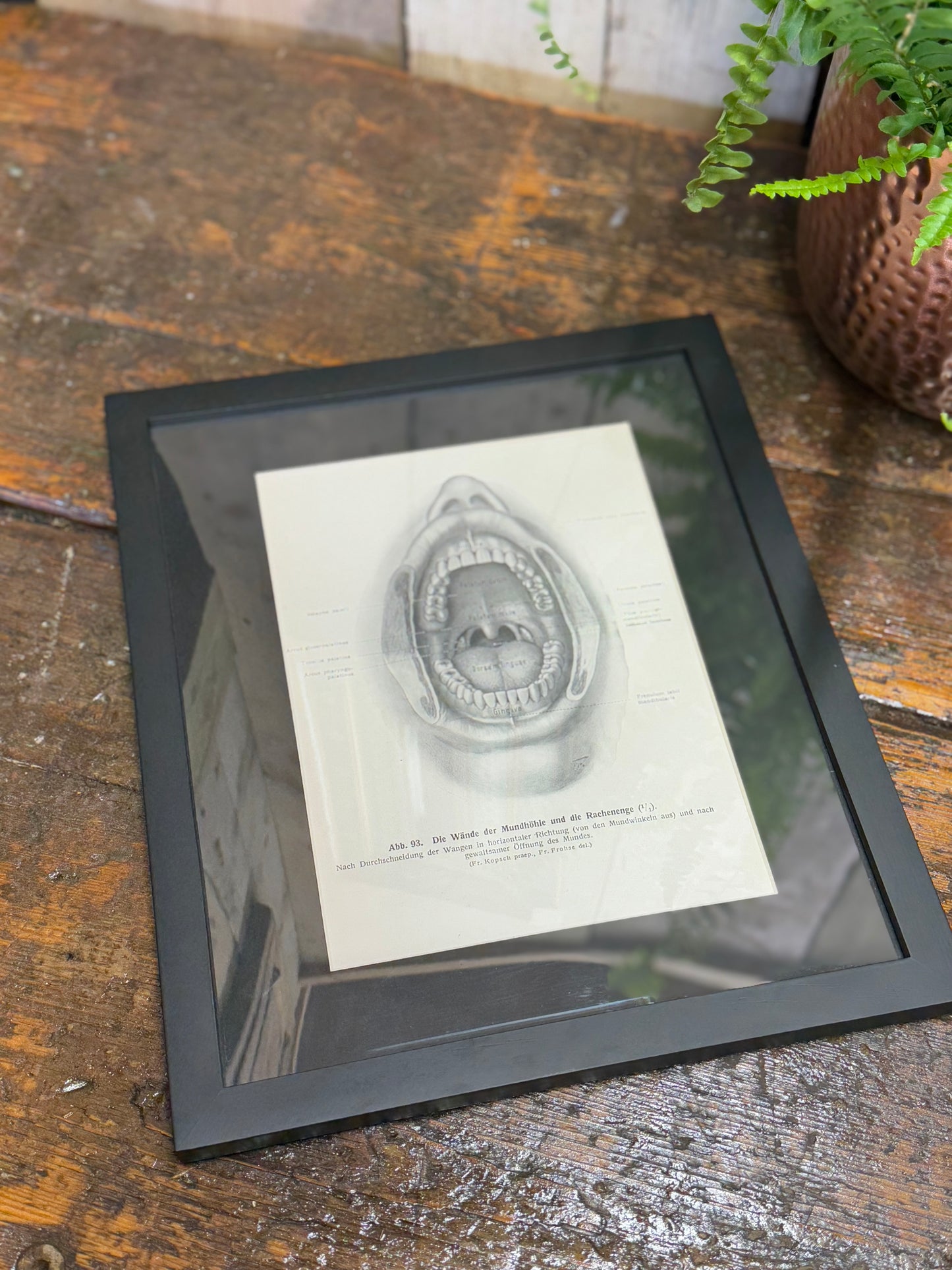 Victorian Anatomy Engraving – Antique Medical Print R