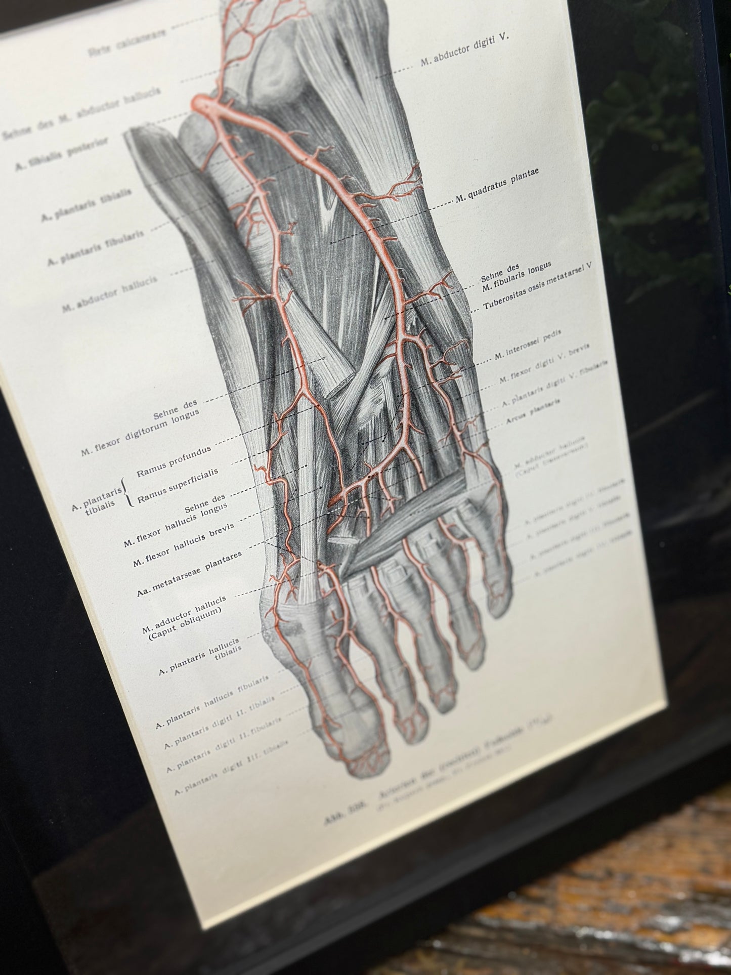 Framed Antique Anatomy Print 1920s Medical Book Plate Wall Art Picture I