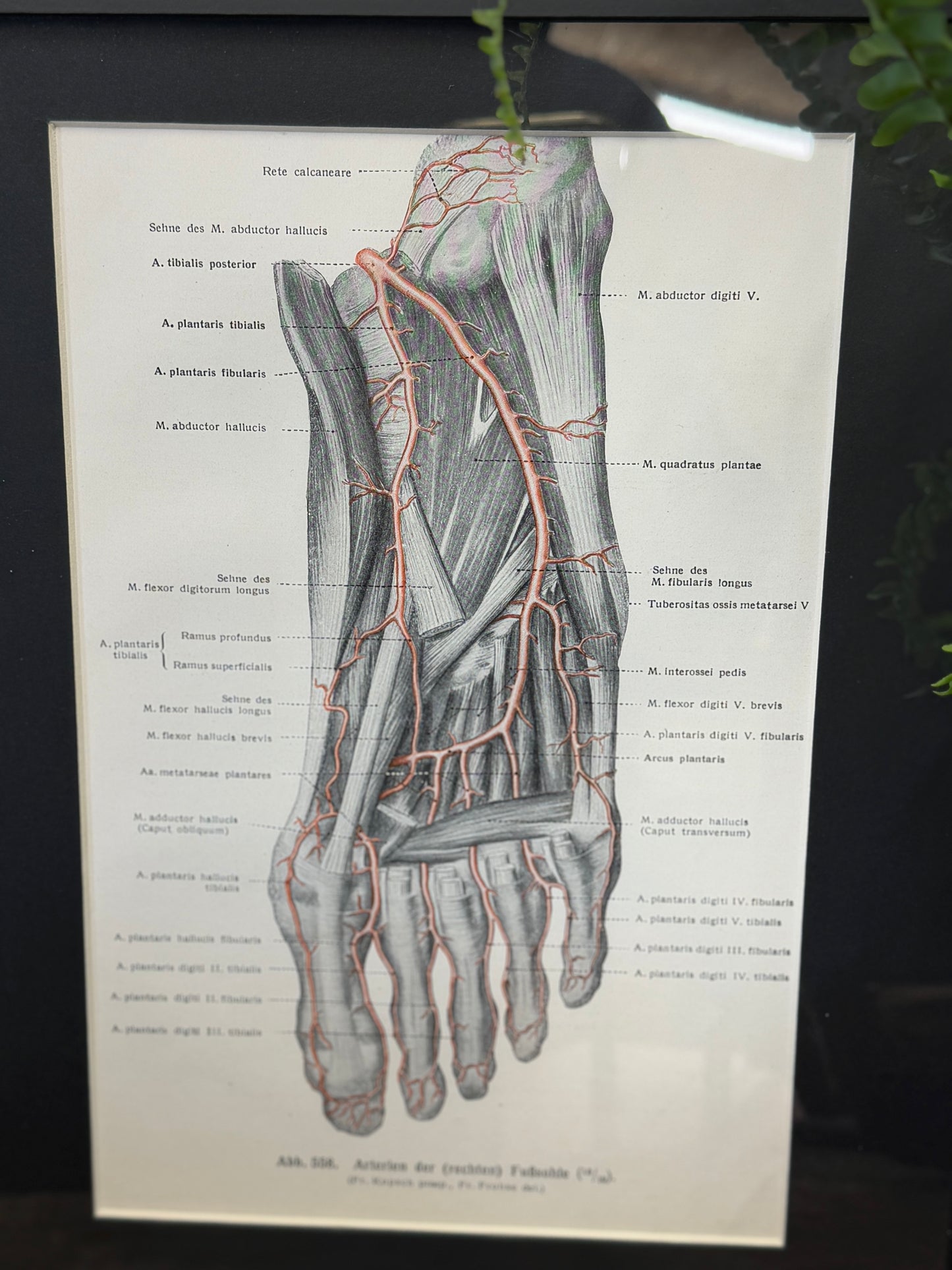 Framed Antique Anatomy Print 1920s Medical Book Plate Wall Art Picture I