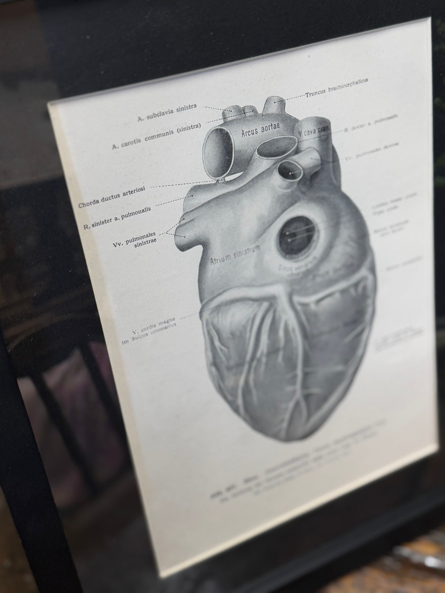 Framed Antique Anatomy Print 1920s Medical Book Plate Wall Art Picture T