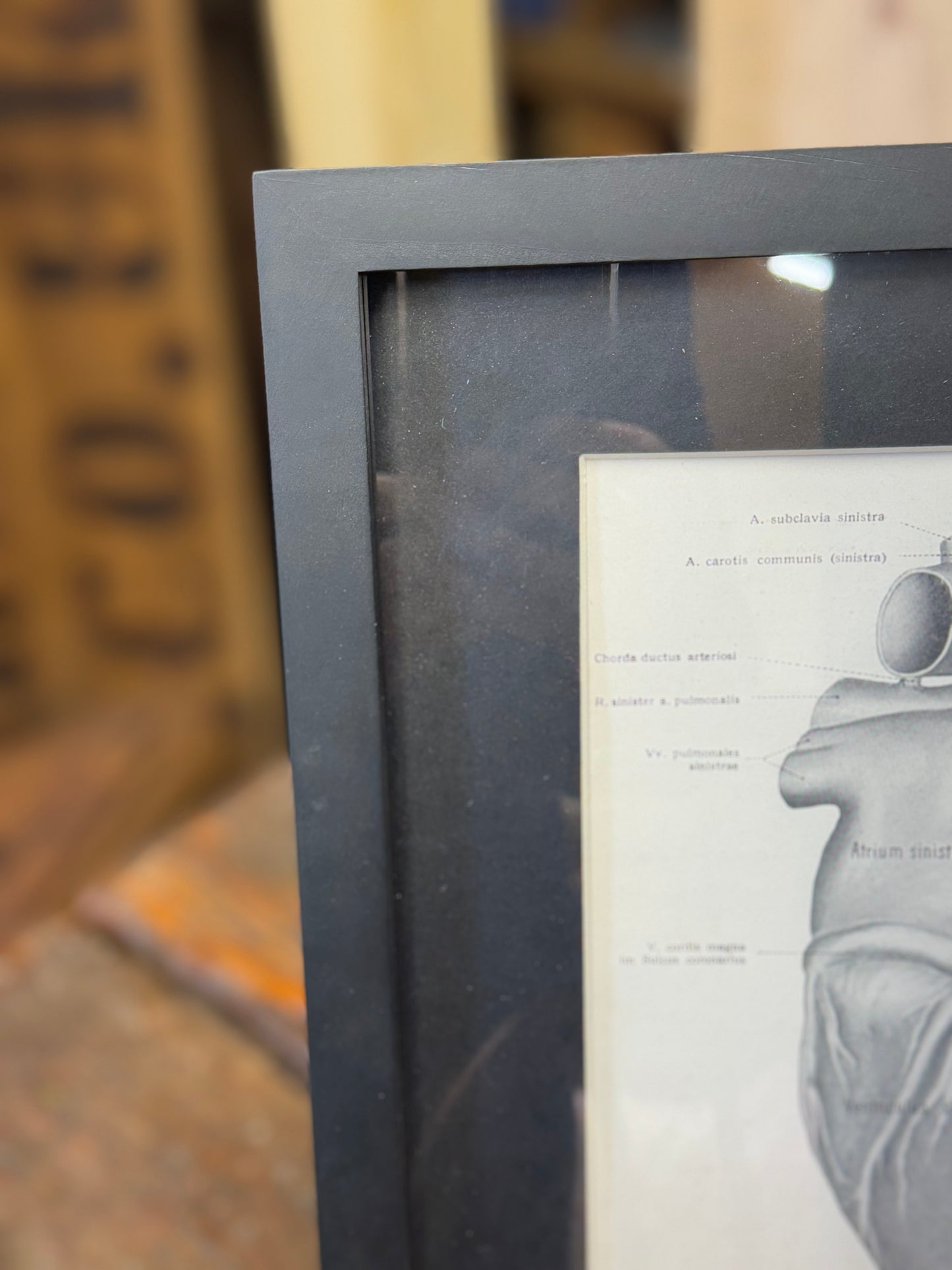 Framed Antique Anatomy Print 1920s Medical Book Plate Wall Art Picture T