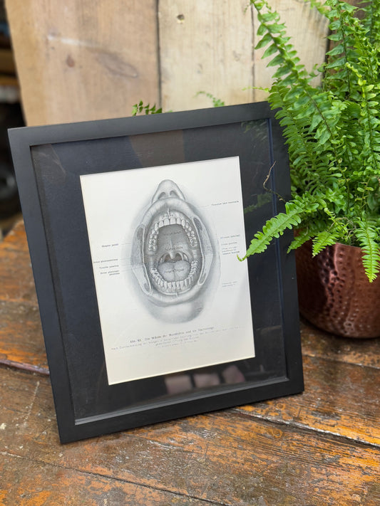 Victorian Anatomy Engraving – Antique Medical Print R