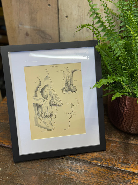 Victorian Anatomy Engraving – Antique Medical Print L