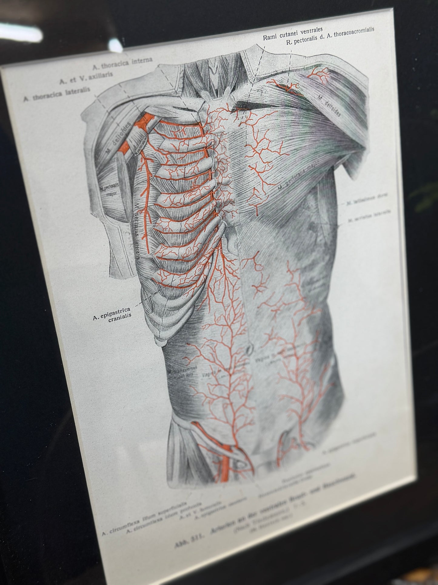 Framed Antique Anatomy Print 1920s Medical Book Plate Wall Art Picture U