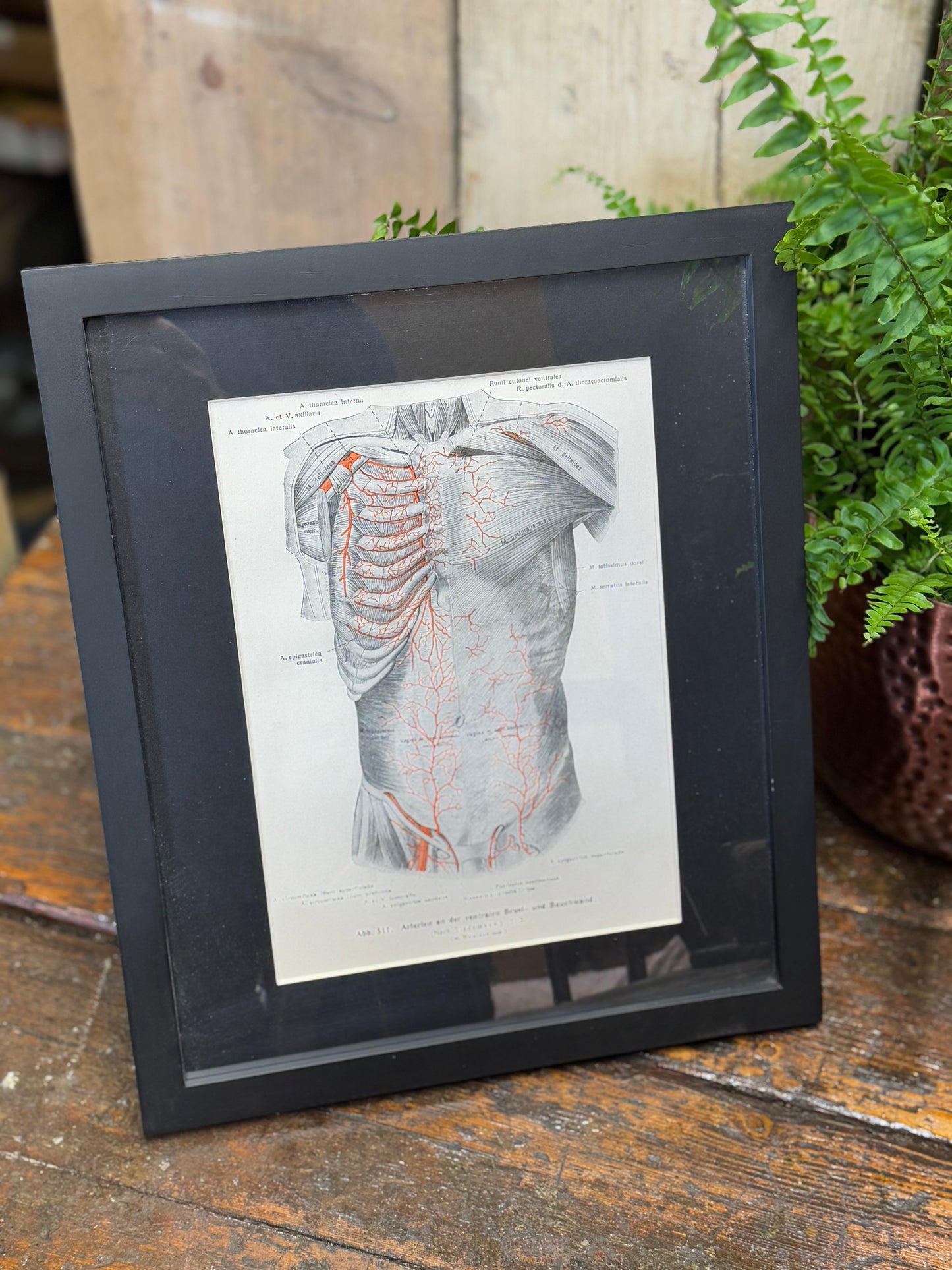 Framed Antique Anatomy Print 1920s Medical Book Plate Wall Art Picture U