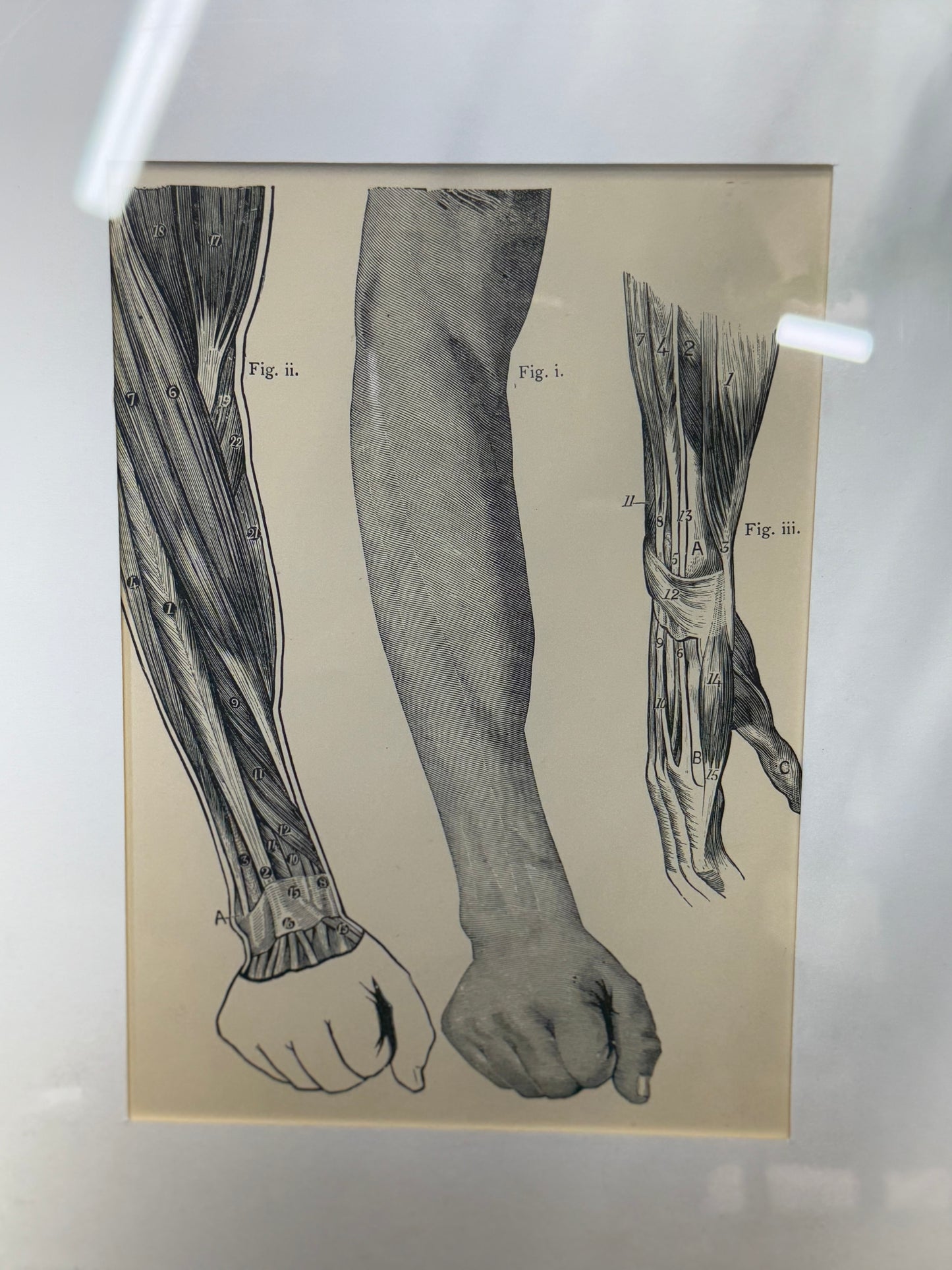 Victorian Anatomy Engraving – Antique Medical Print S