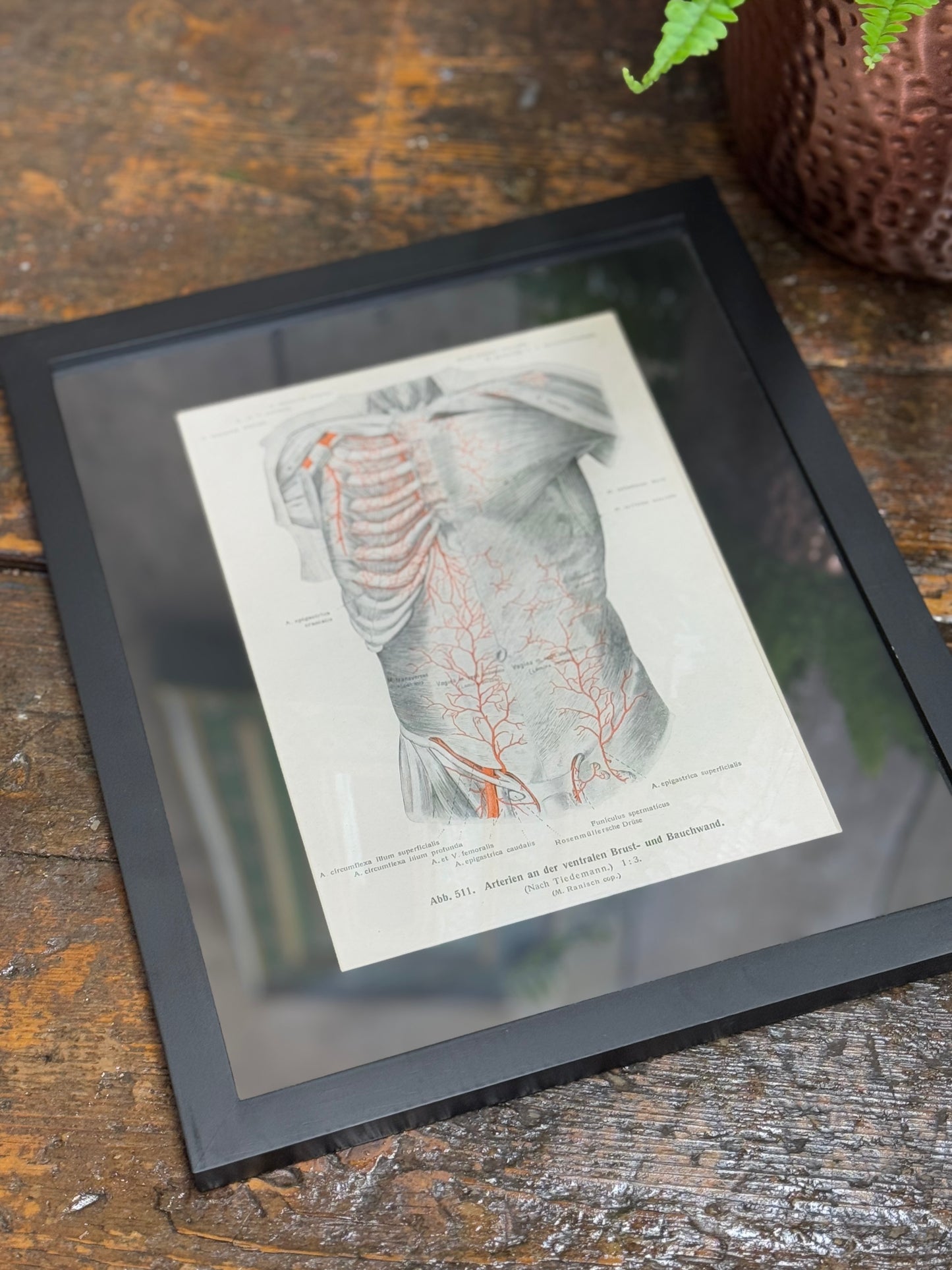 Framed Antique Anatomy Print 1920s Medical Book Plate Wall Art Picture U