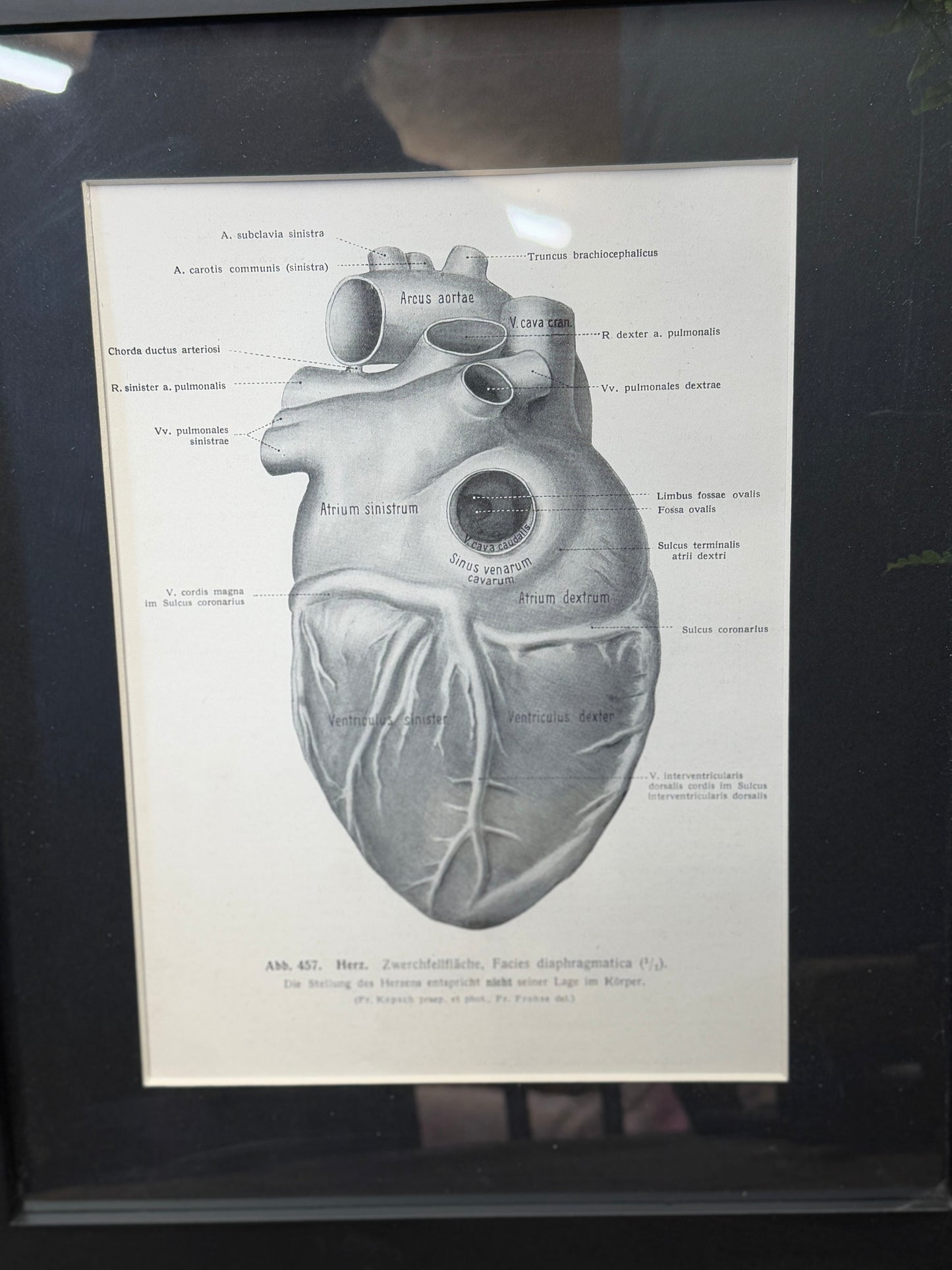 Framed Antique Anatomy Print 1920s Medical Book Plate Wall Art Picture T