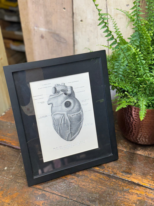 Framed Antique Anatomy Print 1920s Medical Book Plate Wall Art Picture T