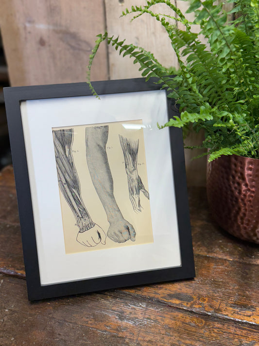 Victorian Anatomy Engraving – Antique Medical Print S
